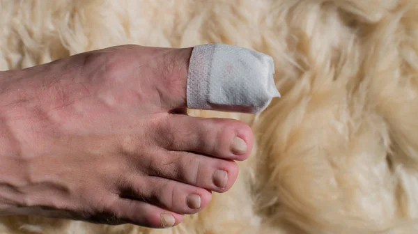 Операция на большом пальце ноги в больнице — стоковое фото