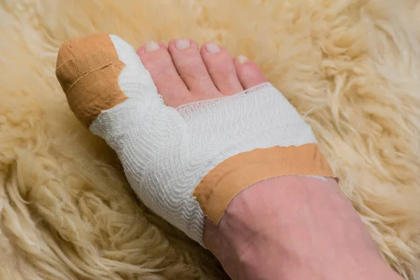 Операция на большом пальце ноги в больнице — стоковое фото