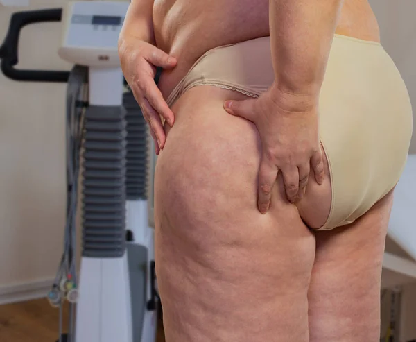 Übergewichtige Frau Behandlungsraum Beim Arzt — Stockfoto