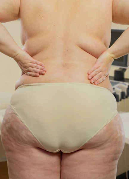 Übergewichtige Frau Behandlungsraum Beim Arzt — Stockfoto