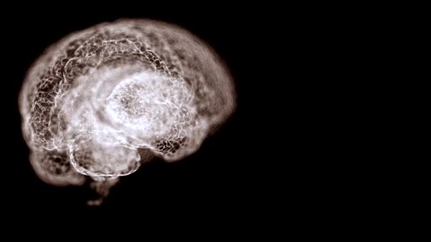 Vídeo de ressonância magnética do cérebro humano sobre fundo preto . — Vídeo de Stock