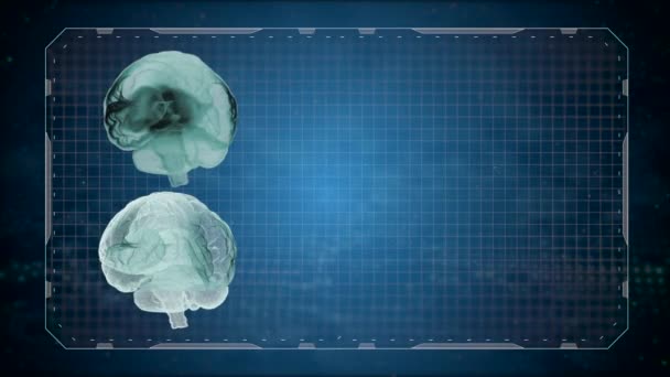 Tomografía médica computarizada Resonancia magnética del cerebro humano sobre fondo oscuro cuadriculado . — Vídeos de Stock
