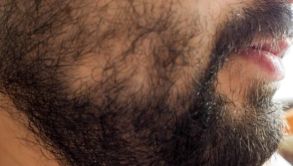 Erkek çene dudakları ve yanakları kıllı kenarların ortalama uzunluğunda.