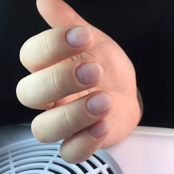 マニキュアの前の女性の爪 暗い背景に未処理の女性の爪のクローズアップハードウェアマニキュアの後の女性の手 — ストック写真