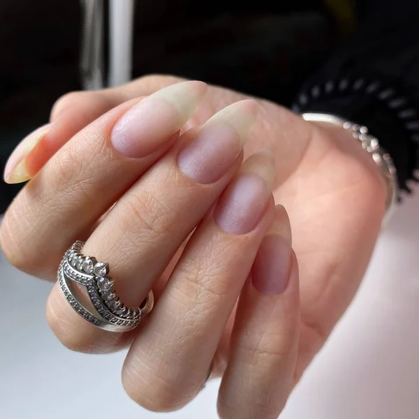 Unhas Mulher Sem Manicure Uma Mão Mulher Sem Manicure Nas — Fotografia de Stock