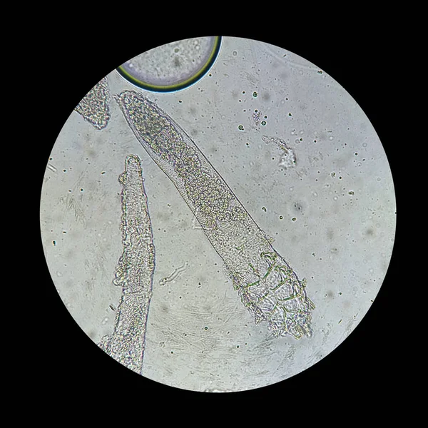 Demodex mite από μικροσκόπιο. Το παράσιτο που προκαλεί μια ασθένεια του δέρματος -Demodecosis. — Φωτογραφία Αρχείου