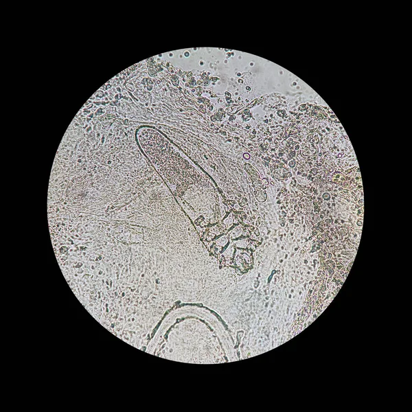Клещ демодекса с микроскопа. Паразит, вызывающий кожные заболевания - Демодекоз . — стоковое фото