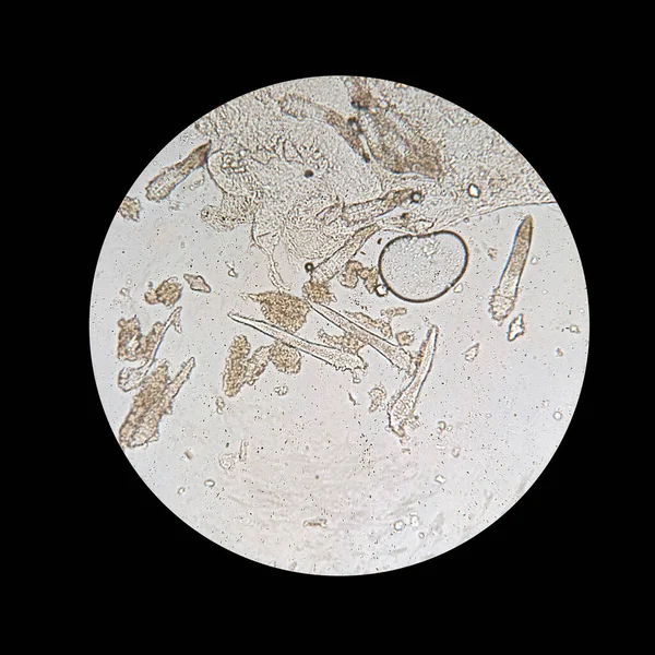 从显微镜下观察到的线虫.引起皮肤病的寄生虫--脱皮病. — 图库照片