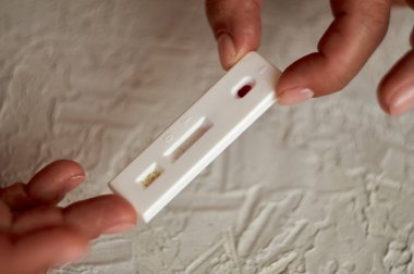 Virüsler için kan testi. Kız kendini hepatit, herpes ve Epstein-Barr virüsü, adenovirüs, frengi, HIV ve diğer cinsel enfeksiyonlar için kontrol ediyor..