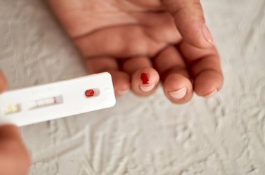 Virüsler için kan testi. Kız kendini hepatit, herpes ve Epstein-Barr virüsü, adenovirüs, frengi, HIV ve diğer cinsel enfeksiyonlar için kontrol ediyor..