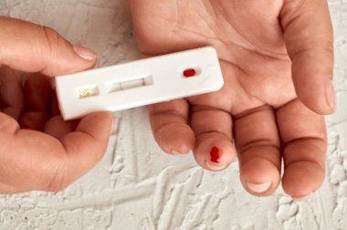 Virüsler için kan testi. Kız kendini hepatit, herpes ve Epstein-Barr virüsü, adenovirüs, frengi, HIV ve diğer cinsel enfeksiyonlar için kontrol ediyor..