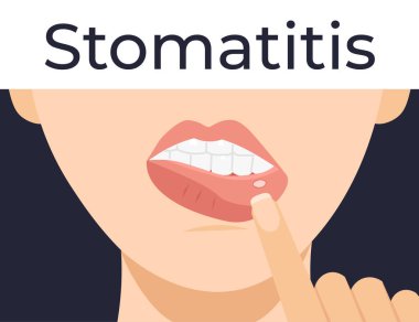 Stomatitis. Woman has inflammation of the mouth and lips. Flat vector cartoon modern illustration. clipart