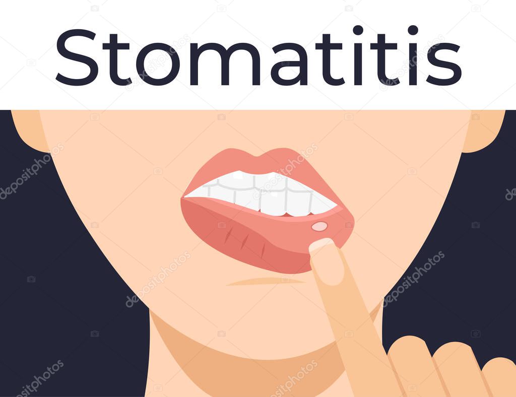 Stomatitis. Woman has inflammation of the mouth and lips. Flat vector cartoon modern illustration.