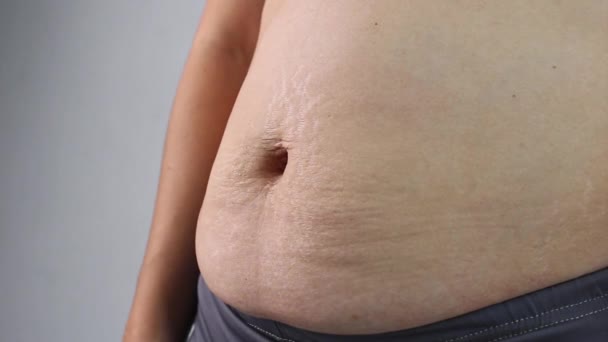 Primer Plano Mano Mujer Pellizcar Grasa Abdominal Excesiva Aislado Sobre — Vídeo de stock