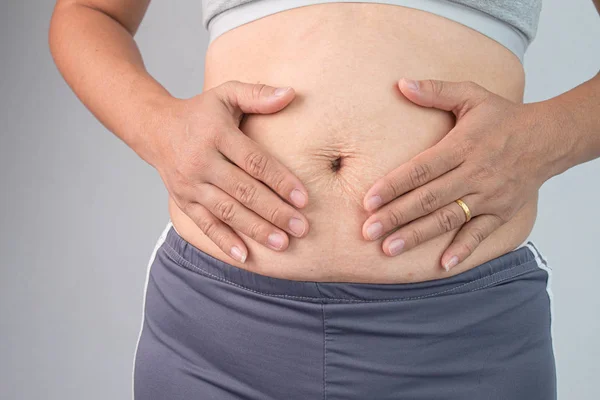 Close up de Mulher tocando a pele da barriga com estrias e loo — Fotografia de Stock