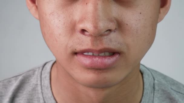Anormal Diş Yapısı Olan Asyalı Gencin Yüzünü Kapatın Sağlık Ağız — Stok video