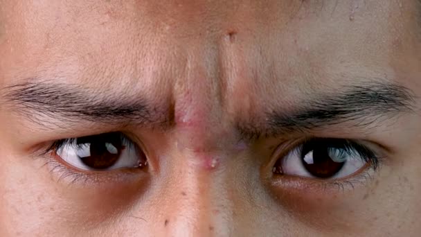 Nahaufnahme Der Gestressten Asiatischen Teenager Kerl Die Augen Auf Weißem — Stockvideo