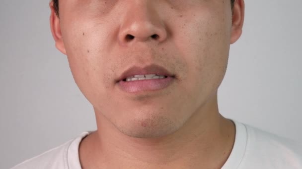 Närbild Ansikte Sömnig Och Gäspade Ung Man Vit Bakgrund — Stockvideo