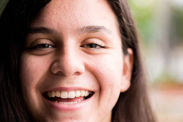 Primer Plano Adolescente Feliz Sonriente — Foto de Stock