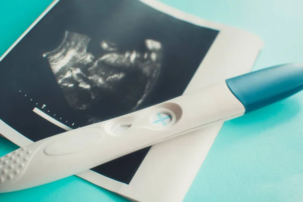 Ultraschall mit positivem Schwangerschaftstest auf blauem Hintergrund. Selektiver Fokus — Stockfoto