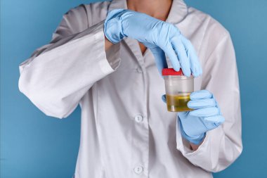 Beyaz üniformalı doktor ve mavi eldivenli doktor idrar tahlili için bir kap açıyor. Klinikte idrar testi ve uyuşturucu