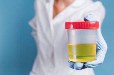Beyaz üniformalı doktor ve mavi eldivenli doktor idrar tahlili için konteynır tutuyor. Klinikte idrar testi ve uyuşturucu