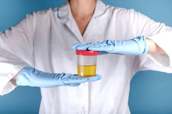 Beyaz üniformalı doktor ve mavi eldivenli doktor eller arasında idrar tahlili için bir kap tutuyor. İdrar testi