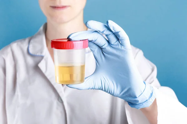 Doktor, beyaz bir elbise ve mavi eldivenli beyaz bir kadın. Elinde sarı idrarlı tıbbi testler için kapalı bir kavanoz tutuyor.
