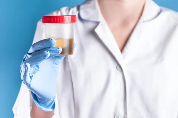 Beyaz önlüklü ve mavi eldivenli bir doktor elinde plastik bir kutu idrar tutuyor. Virüs, alkol, hamilelik, uyuşturucu ve hastalıklar için idrar testleri