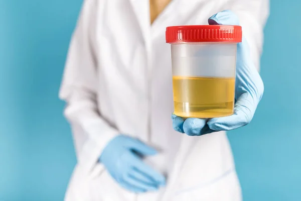 Beyaz önlüklü ve mavi eldivenli bir doktor elinde plastik bir kutu idrar tutuyor. Virüs, alkol, hamilelik, uyuşturucu ve hastalıklar için idrar testleri