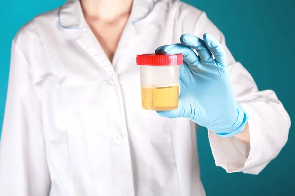 Beyaz üniformalı ve mavi eldivenli bir doktor sarı idrarlı plastik bir test kavanozu tutuyor. Hastalık testi