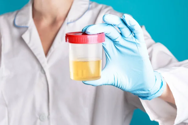 Beyaz üniformalı ve mavi eldivenli bir doktor sarı idrarlı plastik bir test kavanozu tutuyor. Hastalık testi
