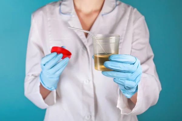 Beyaz üniformalı ve mavi eldivenli bir doktor sarı idrar ve tüplü plastik bir kavanoz tutuyor. Tedavi için idrar içmek