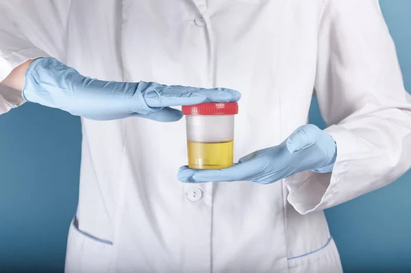 Beyaz üniformalı ve mavi eldivenli bir doktor sarı idrarlı plastik bir test kavanozu tutuyor. Hastalık testi