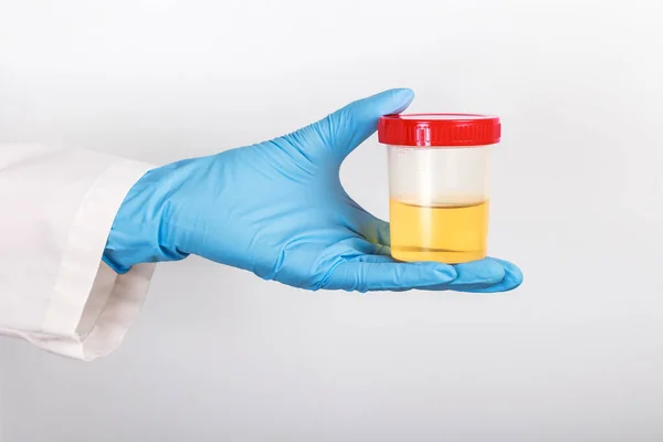 Doktorun Eldivenli Elinde Idrar Testi Yapılan Tüp — Stok fotoğraf