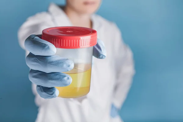 Mavi eldivenli doktor elinde sarı idrar olan plastik bir test kavanozu tutuyor. analiz kavramı