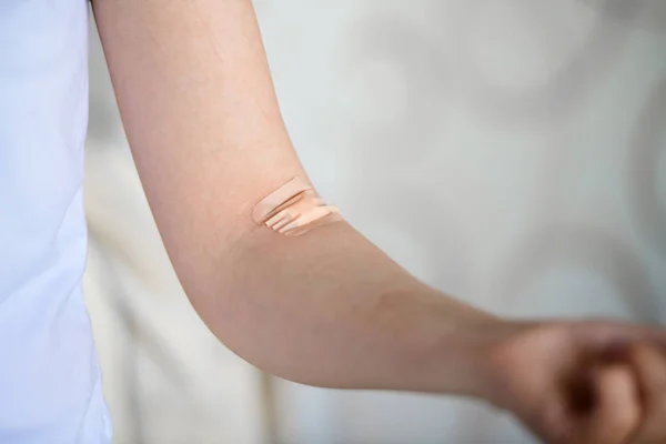 Parche en la mano. donación de sangre de una vena. donación voluntaria. Primer plano. Donación de sangre. Primer plano de la donación de sangre — Foto de Stock