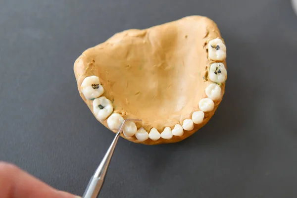 Modelo dentário para formadores. Odontologia da mandíbula simulada dentadura. Boca, educação. amostra de treinamento para um dentista — Fotografia de Stock