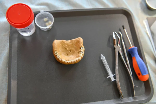 Diseño dental y descomposición dental. dientes falsos. Clase de formación en odontología. niños y dentista. Enseñar la Denticia. Formación en el dentista. — Foto de Stock