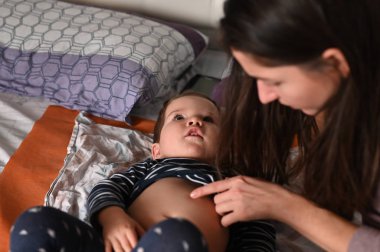 Bebeğin midesinde kızarıklık. Annem bebeğin midesinde kızarıklık fark etti. Yetersiz beslenme. Suçiçeği bebeği. Varisella zoster virüsü ya da kızarıklık. Vücut, sağlık. 