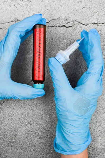 Take Blood Determine Coronavrus Doctor Takes Biochemical Blood Test Detect — Stock Photo, Image