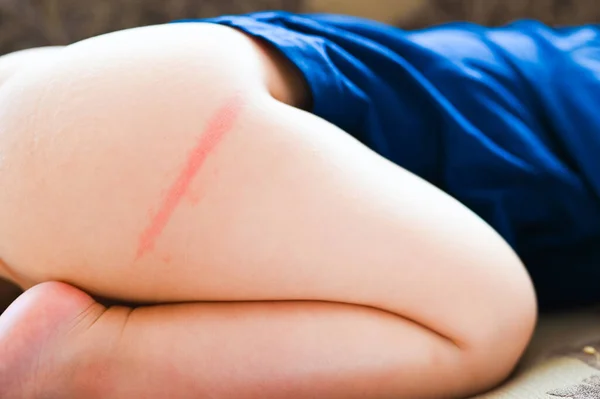 Irritation Bei Einem Kind Durch Windeln Pampers Sind Nicht Groß — Stockfoto
