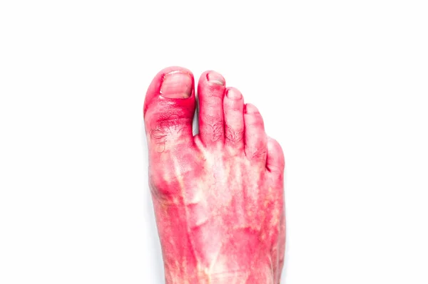 Червона Нога Людини Ізольованому Фоні — стокове фото