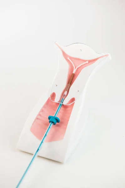 สัญลักษณ์การควบคุมการเกิด iud บนพื้นหลังสีขาว — ภาพถ่ายสต็อก