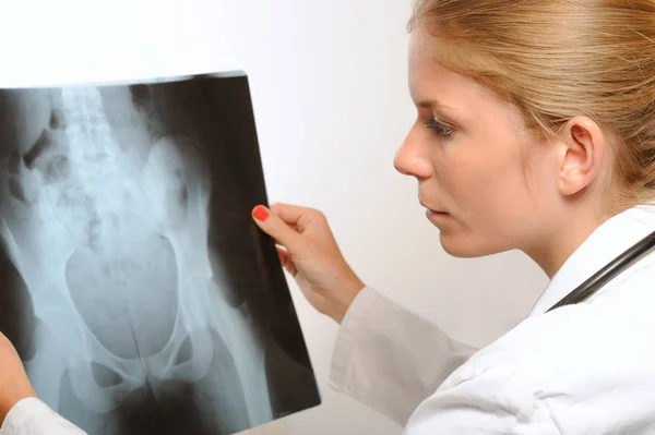 Doctora examinando una imagen de rayos X — Foto de Stock