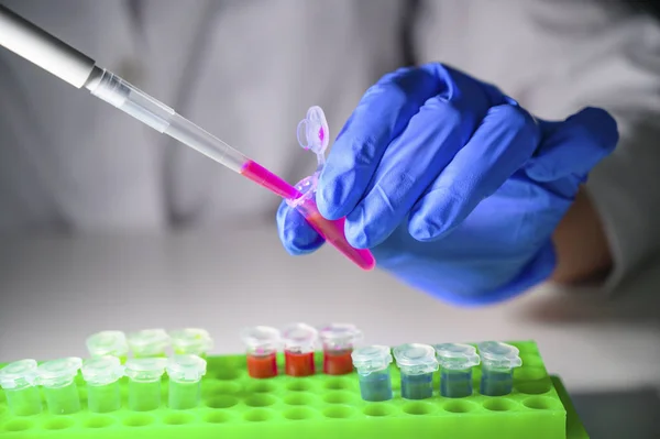 Scientist taking out pink chemical solution in eppendorf tube an