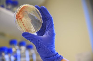 Scientist closely looking at the agar plate for bacterial cultur