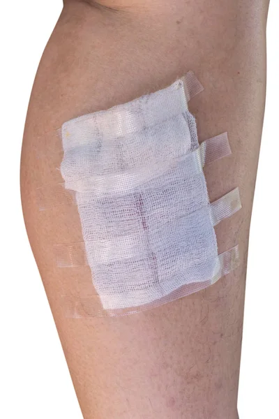 Bandage på benet från hemska burns — Stockfoto