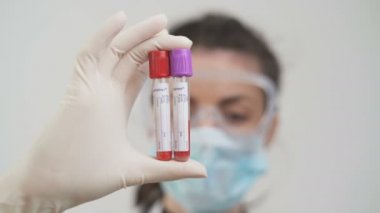 Koronavirüslüler tarafından enfekte edilmiş kan örnekleri. COVID-19 laboratuvar testleri pozitif.