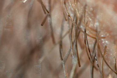 Saçlı üst deri tabakası. Makro. Tıraşlı saç yakın plan..